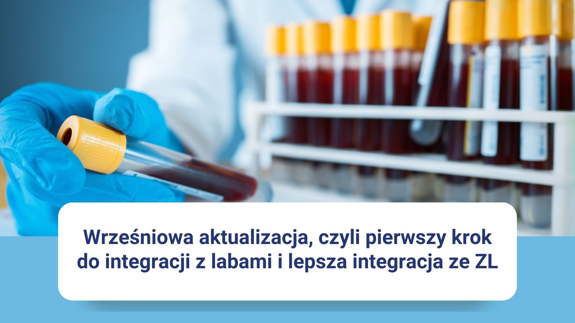 Ręka w rękawiczce trzyma probówkę z krwią, w tle probówki na stojaku, informacja o aktualizacji.